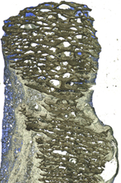 [Thin section of a knob structure]